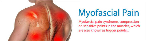 Myofascial-Pain.jpg